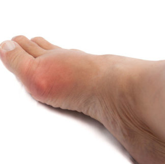 Sprained Toe Vs. Broken Toe – to Know the Difference | Web Health Wire