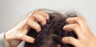 causes of itchy scalp
